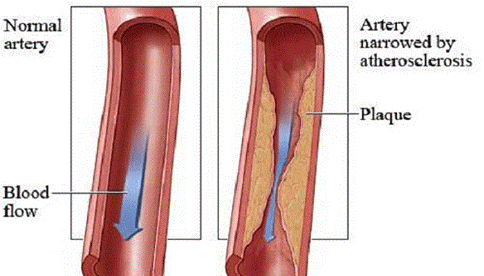 artery function-Netmarkers
