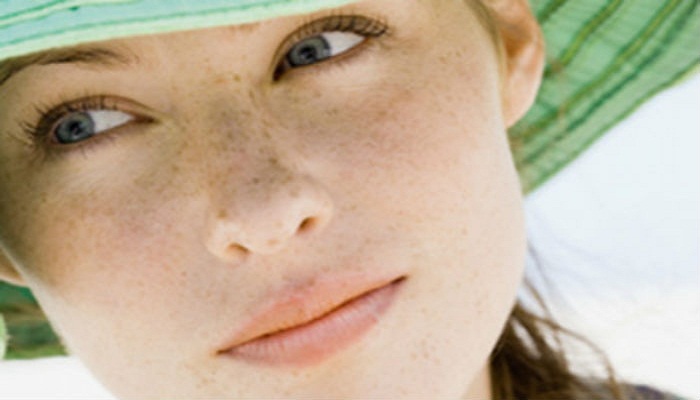 dark-spots on face-Netmarkers