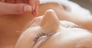 acupuncture treatment practise-Netmarkers