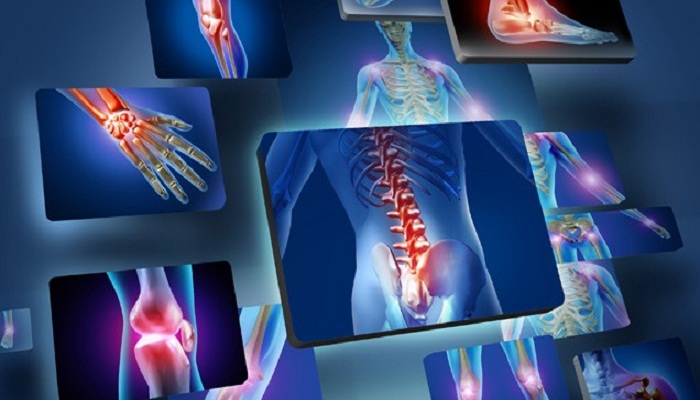 joint pain-Netmarkers