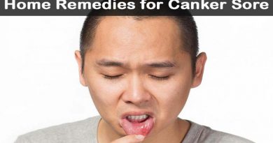 canker-sore-remedies-netmarkers
