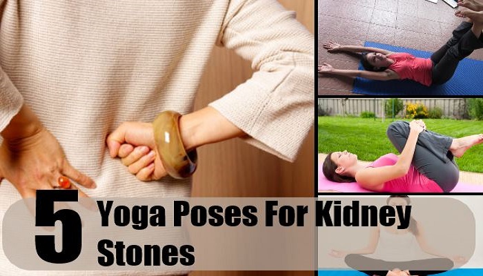 top-5-yoga-asanas-to-treat-kidney-stones-netmarkers
