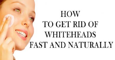 how-to-get-rid-of-whiteheads-netmarkers
