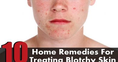 remedies-for-blotchy-and-uneven-skin-netmarkers