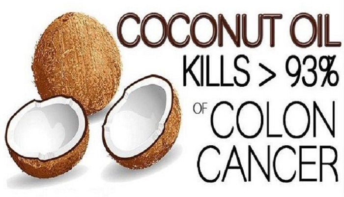 scientist-discover-coconut-oil-kill-93-percent-of-colon-cancer-cells-in-2-days-netmarkers