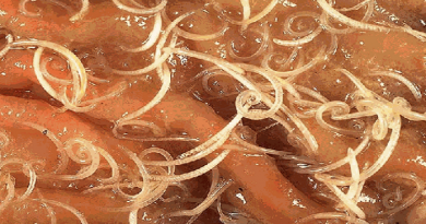 tapeworm-infection-from-sushi-netmarkers