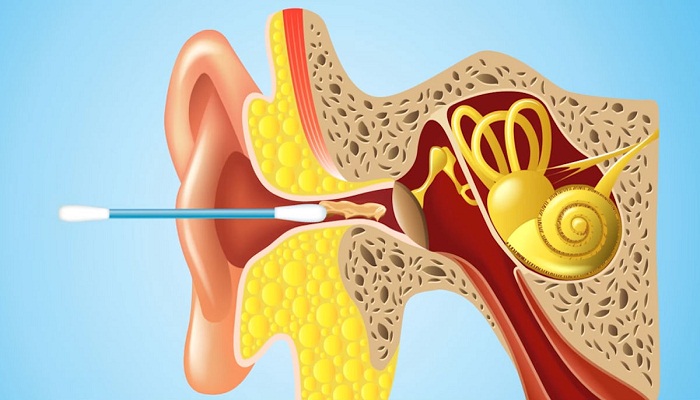Earwax-comes-with-several-benefits-Netmarkers