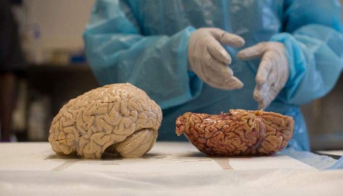 Scientist-research-on-brains-of-clinically-dead-people-Netmarkers
